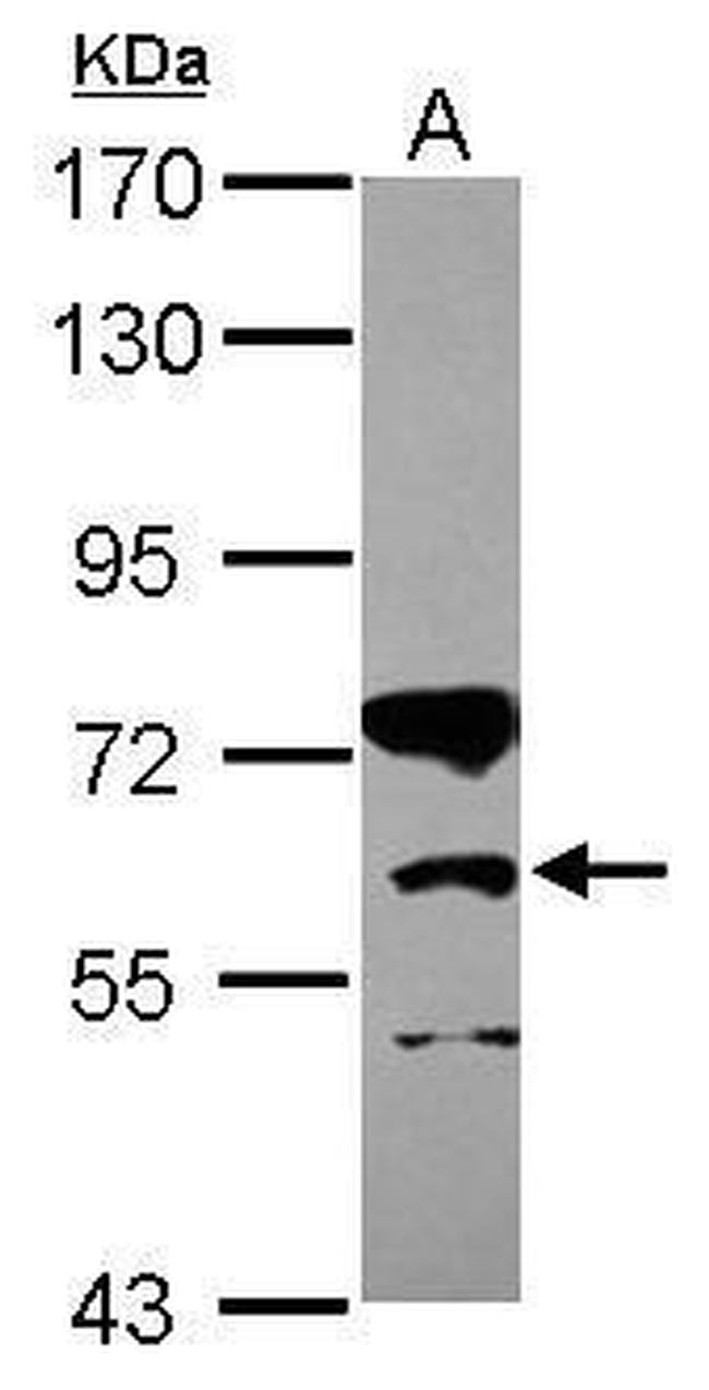 CPT1B Polyclonal Antibody (PA5-30896)