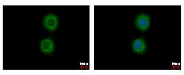 KRT72 Antibody in Immunocytochemistry (ICC/IF)