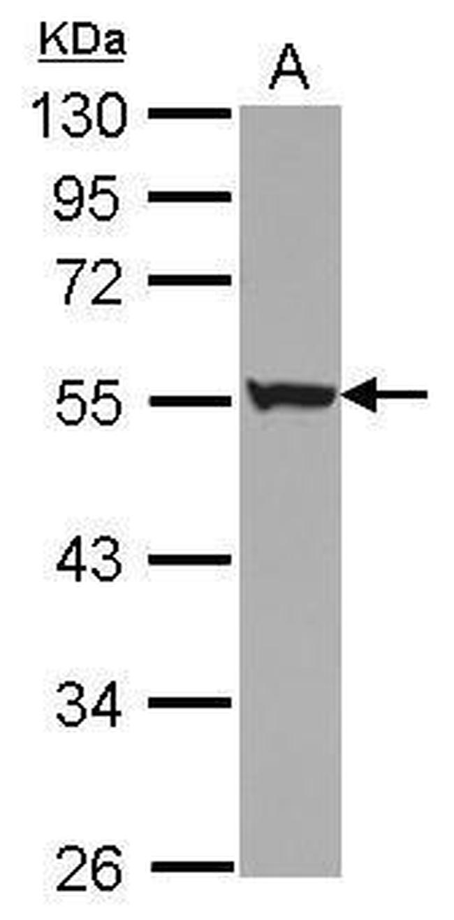 KRT72 Antibody in Western Blot (WB)