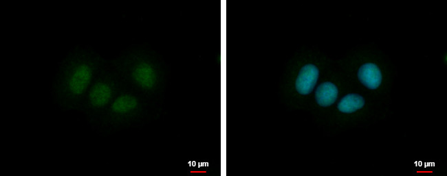 ZNF554 Antibody in Immunocytochemistry (ICC/IF)