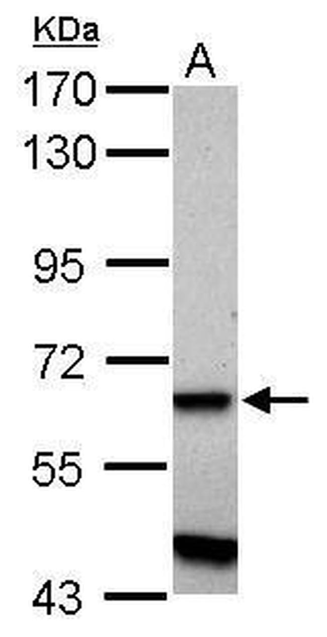 ZNF554 Antibody in Western Blot (WB)