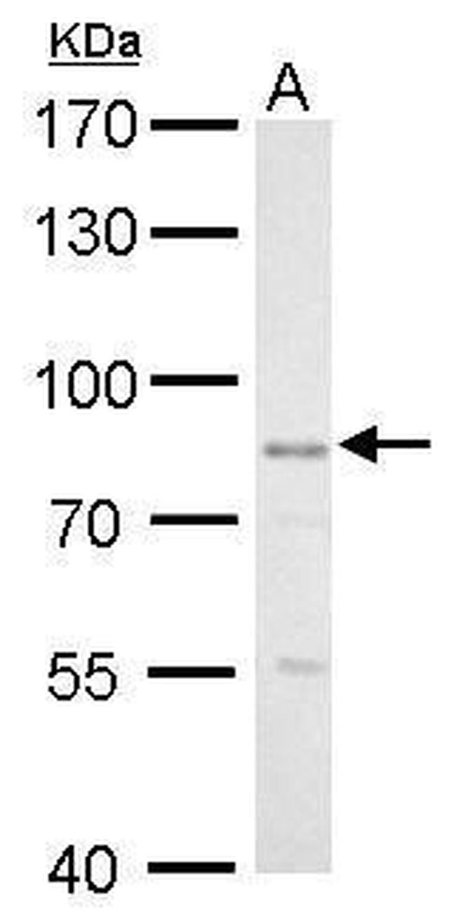 GLIS3 Antibody in Western Blot (WB)