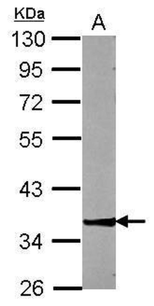 ZNF396 Antibody in Western Blot (WB)