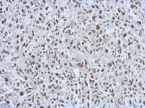 RALY Antibody in Immunohistochemistry (Paraffin) (IHC (P))