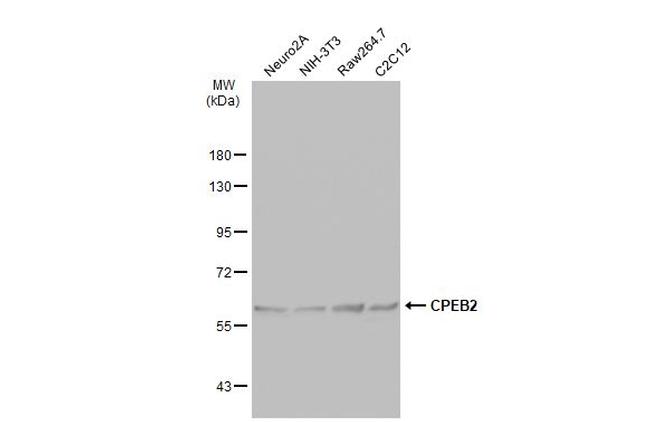 CPEB2 Antibody in Western Blot (WB)