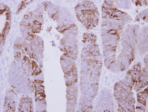 COLQ Antibody in Immunohistochemistry (Paraffin) (IHC (P))