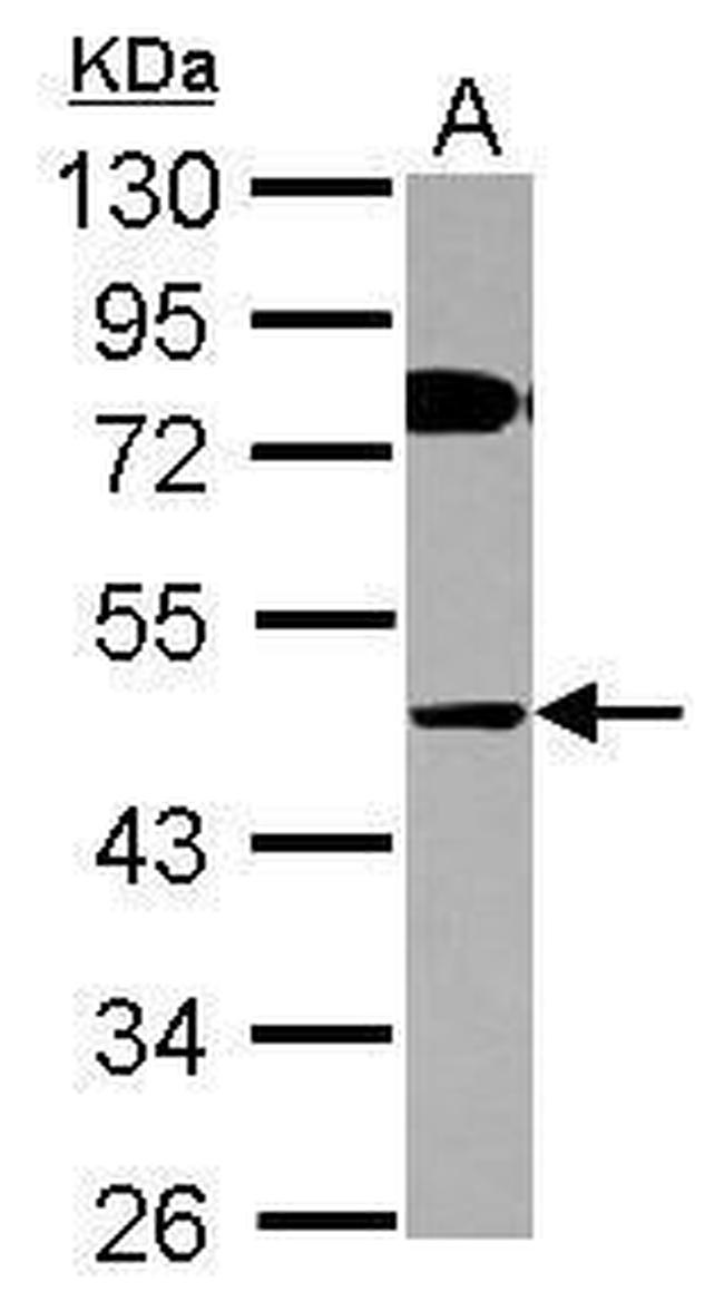 COLQ Antibody in Western Blot (WB)