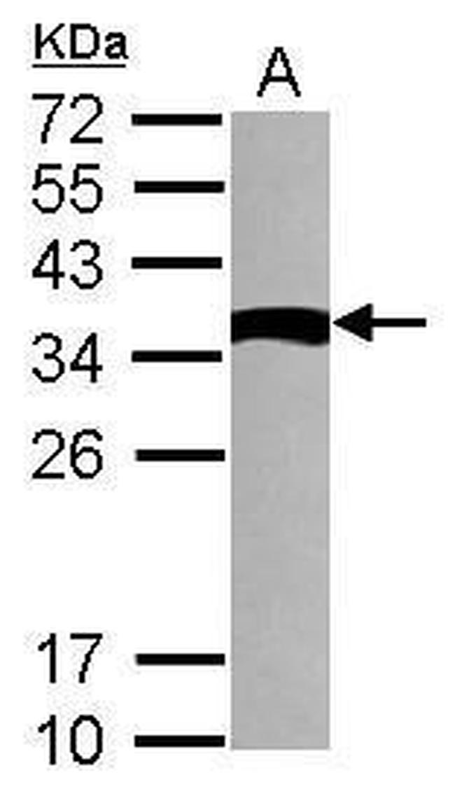 TXNDC6 Antibody in Western Blot (WB)