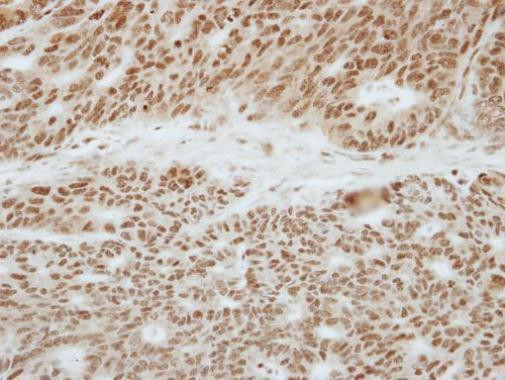 TOE1 Antibody in Immunohistochemistry (Paraffin) (IHC (P))