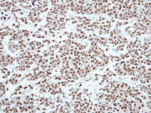 HP1 gamma Antibody in Immunohistochemistry (Paraffin) (IHC (P))