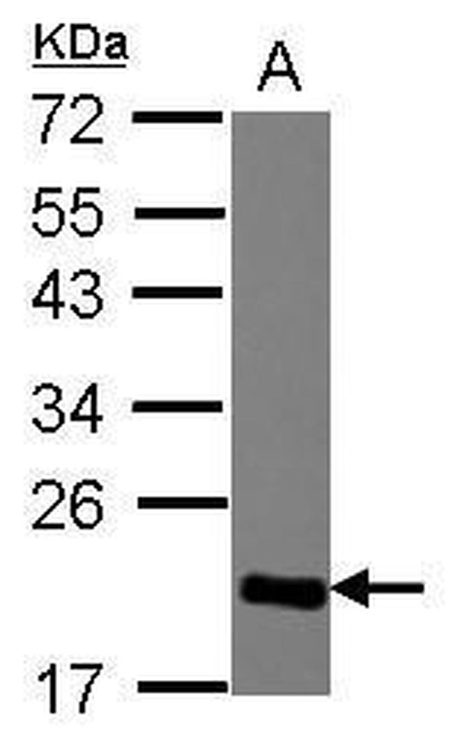 HP1 gamma Antibody in Western Blot (WB)