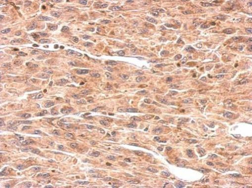 OMD Antibody in Immunohistochemistry (Paraffin) (IHC (P))