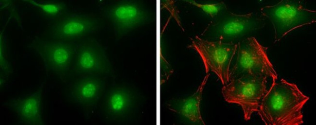 MA2 Antibody in Immunocytochemistry (ICC/IF)