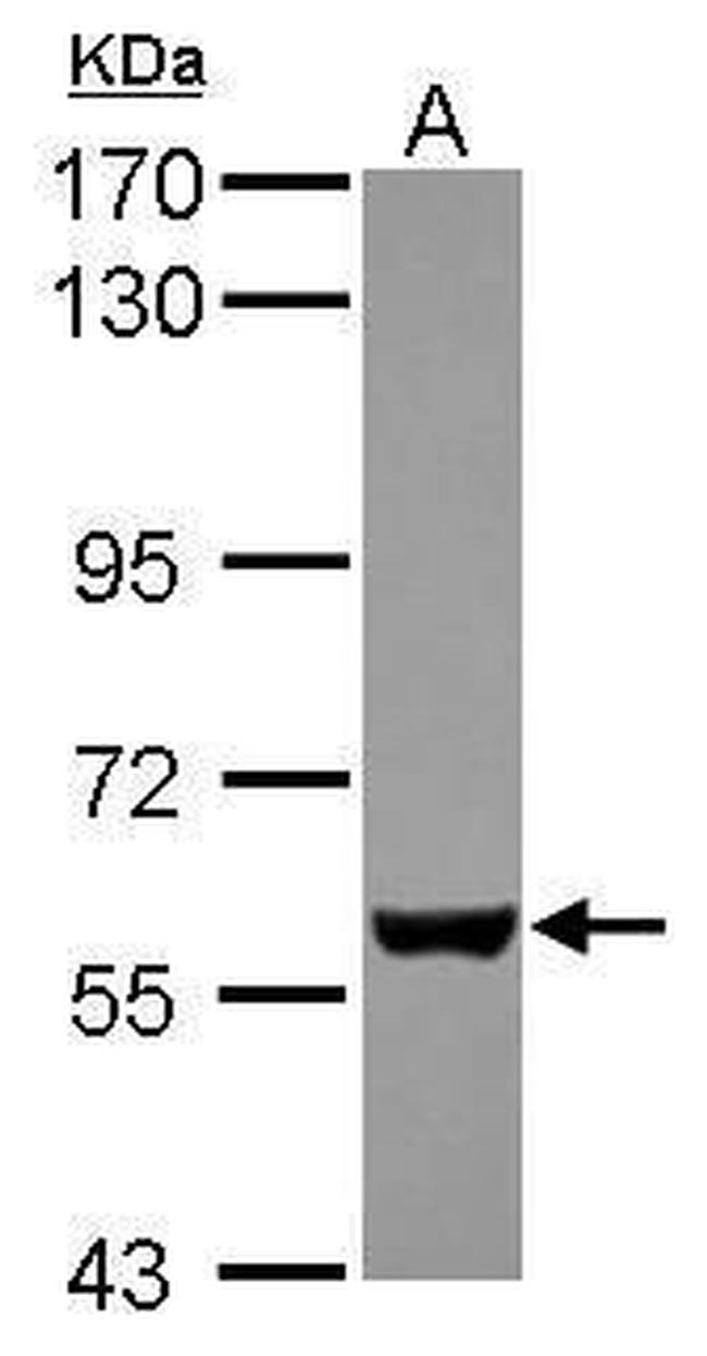 EBF3 Antibody in Western Blot (WB)