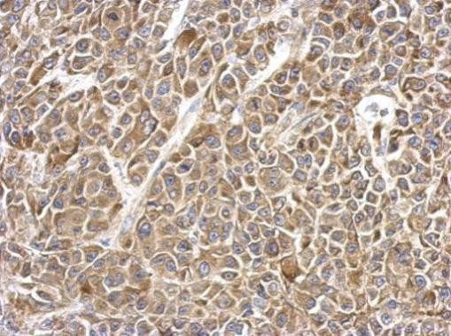 UBE2V2 Antibody in Immunohistochemistry (Paraffin) (IHC (P))