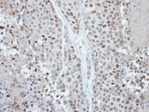 CDYL Antibody in Immunohistochemistry (Paraffin) (IHC (P))