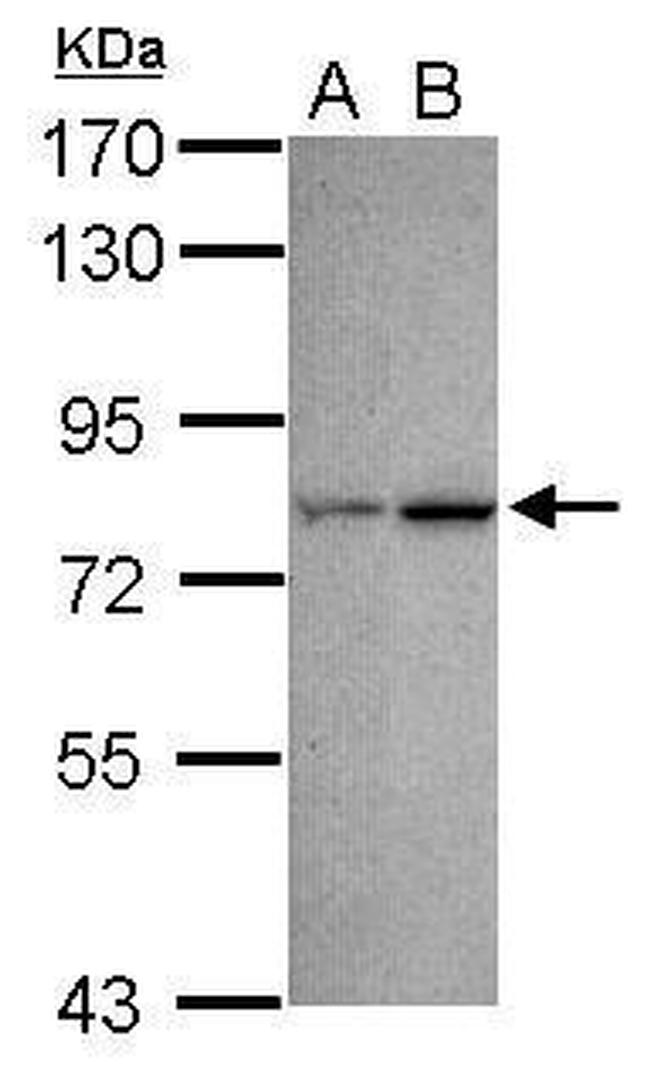 CDYL Antibody in Western Blot (WB)