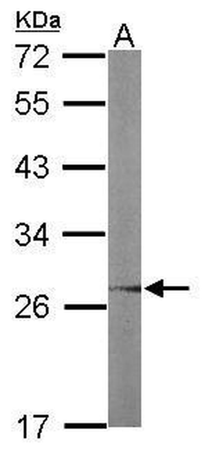 UBC3B Antibody in Western Blot (WB)