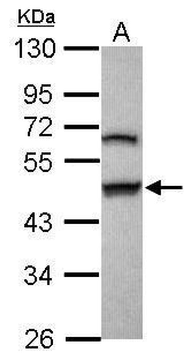 GSDMB Antibody in Western Blot (WB)