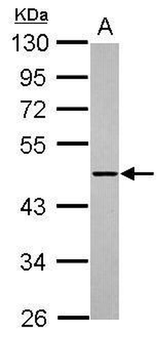 ADAMTSL1 Antibody in Western Blot (WB)