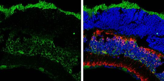 MSI2 Antibody in Immunohistochemistry (Frozen) (IHC (F))