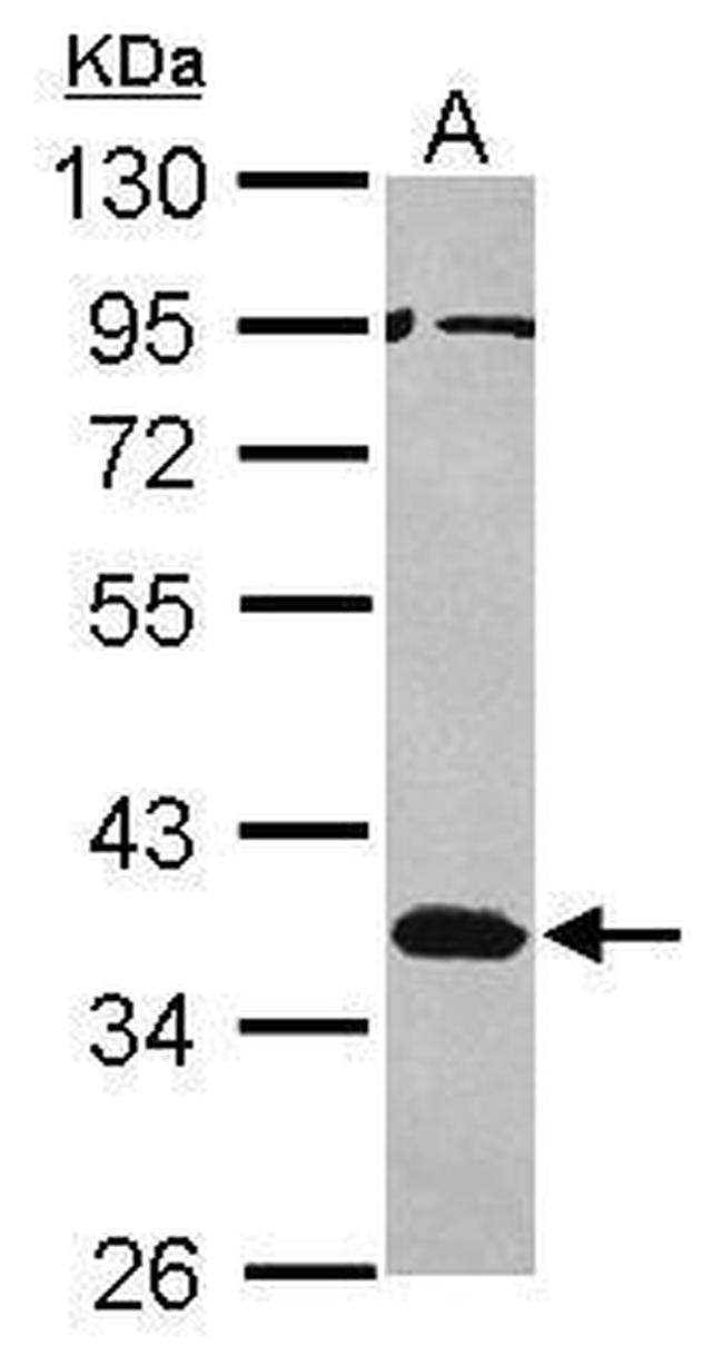 MSI2 Antibody in Western Blot (WB)