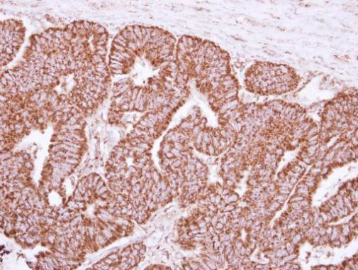 Cyclophilin F Antibody in Immunohistochemistry (Paraffin) (IHC (P))