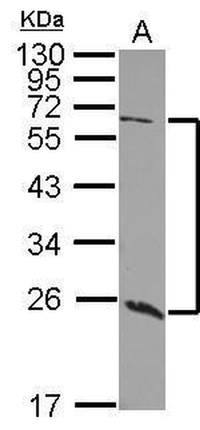 GALNT9 Antibody in Western Blot (WB)