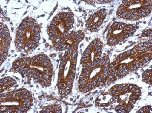 MRPS18B Antibody in Immunohistochemistry (Paraffin) (IHC (P))