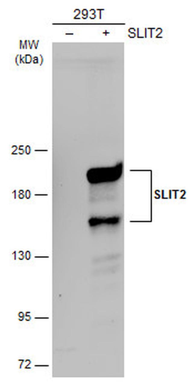 SLIT2 Polyclonal Antibody (PA5-31133)