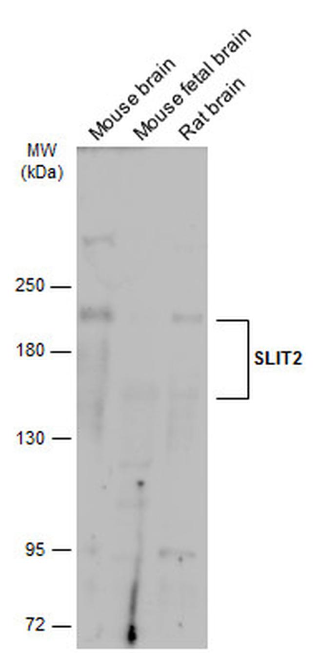 SLIT2 Polyclonal Antibody (PA5-31133)