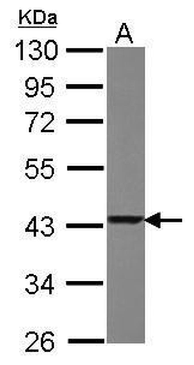 TXNL2 Antibody in Western Blot (WB)