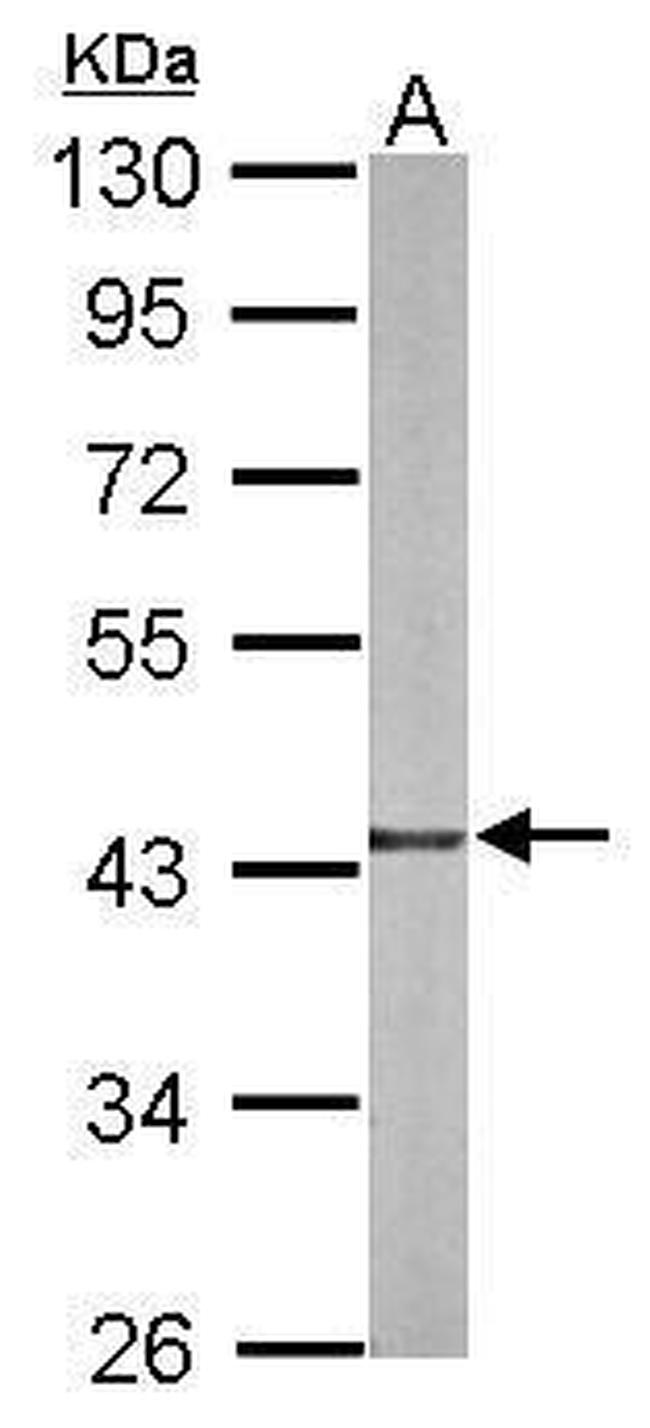 TXNL2 Antibody in Western Blot (WB)