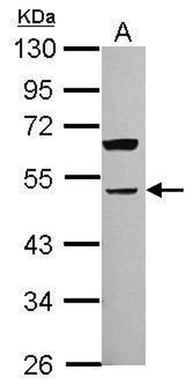 PARVA Antibody in Western Blot (WB)