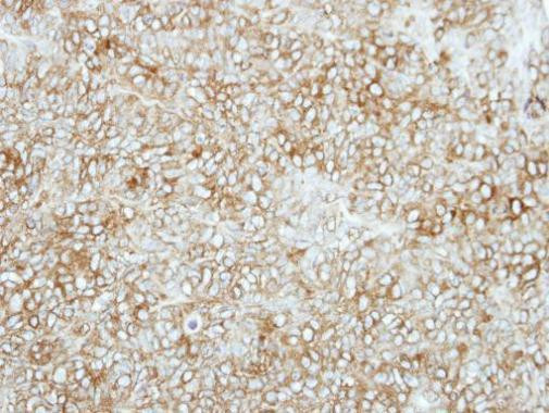 SEMA6C Antibody in Immunohistochemistry (Paraffin) (IHC (P))