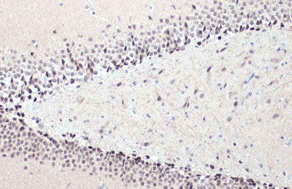 NFIX Antibody in Immunohistochemistry (Paraffin) (IHC (P))