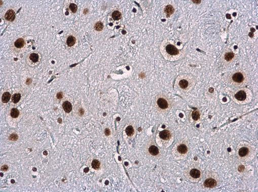 WBP11 Antibody in Immunohistochemistry (Paraffin) (IHC (P))