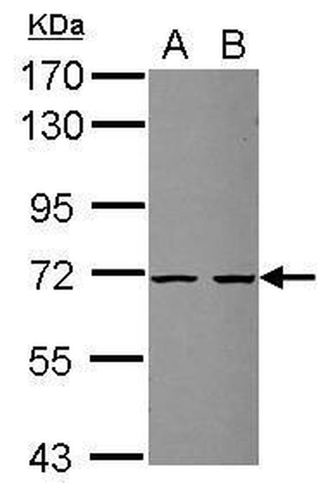 ZSWIM2 Antibody in Western Blot (WB)