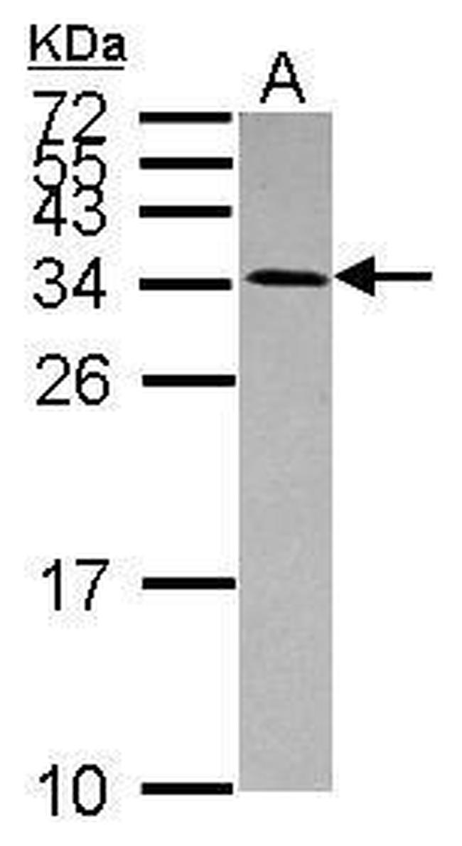USE1 Antibody in Western Blot (WB)