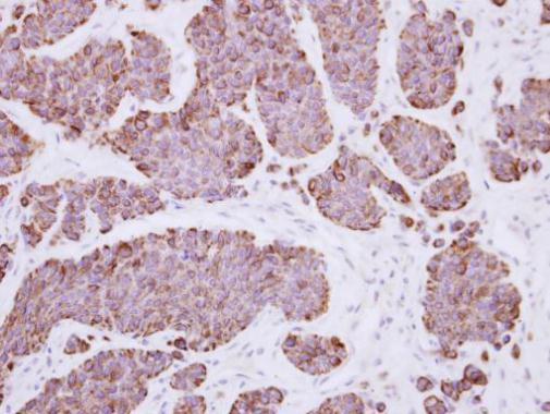 PLEKHF2 Antibody in Immunohistochemistry (Paraffin) (IHC (P))