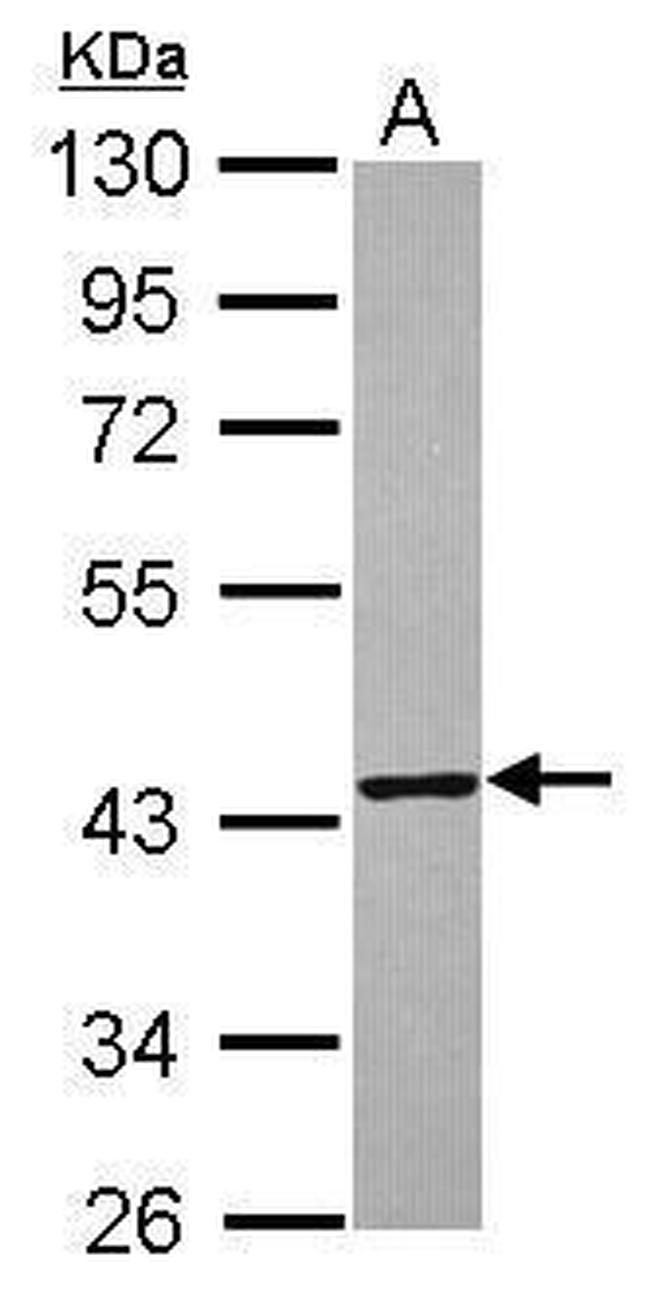 TXNL2 Antibody in Western Blot (WB)