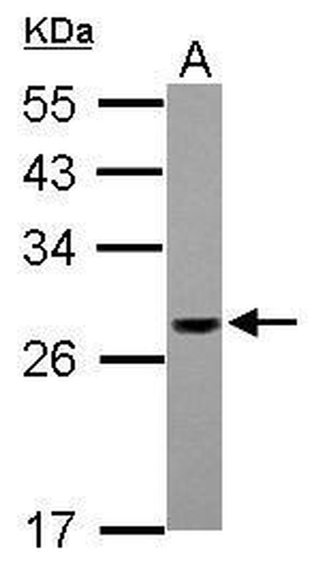 PSMG1 Antibody in Western Blot (WB)