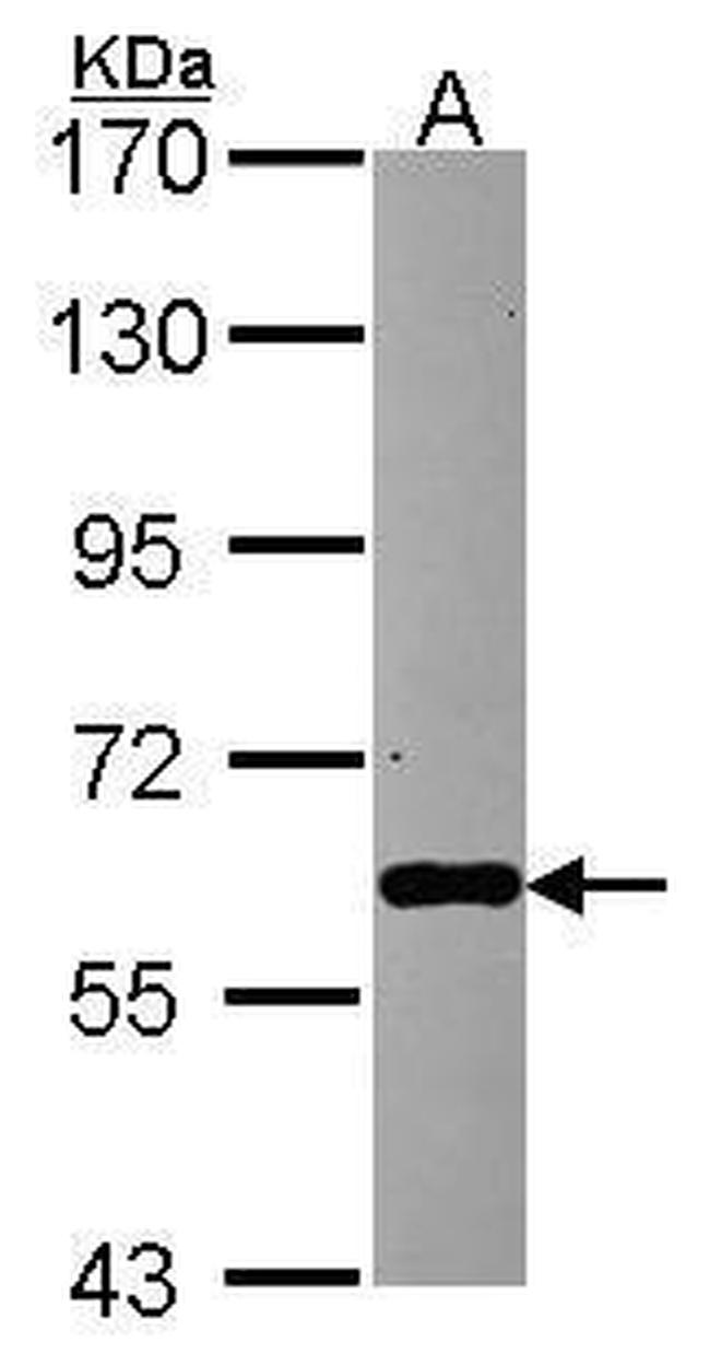 MTPAP Antibody in Western Blot (WB)