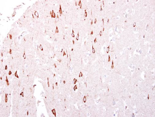 GTPBP3 Antibody in Immunohistochemistry (Paraffin) (IHC (P))