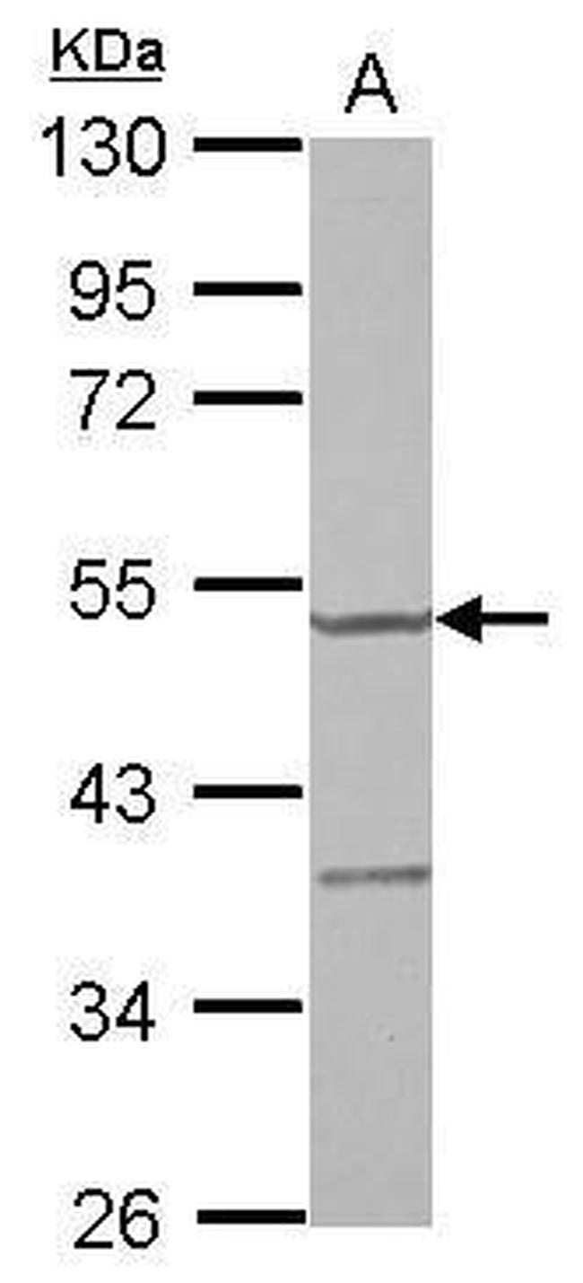 YARS2 Antibody in Western Blot (WB)