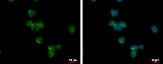 CD37 Antibody in Immunocytochemistry (ICC/IF)