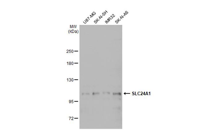SLC24A1 Antibody in Western Blot (WB)