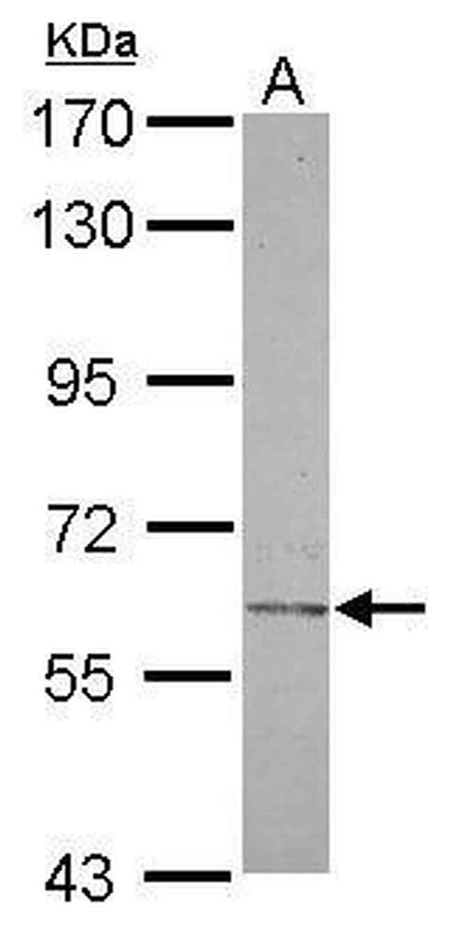 CHST2 Antibody in Western Blot (WB)