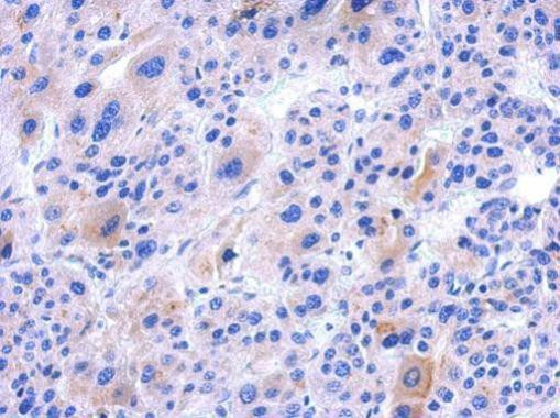 IFT122 Antibody in Immunohistochemistry (Paraffin) (IHC (P))