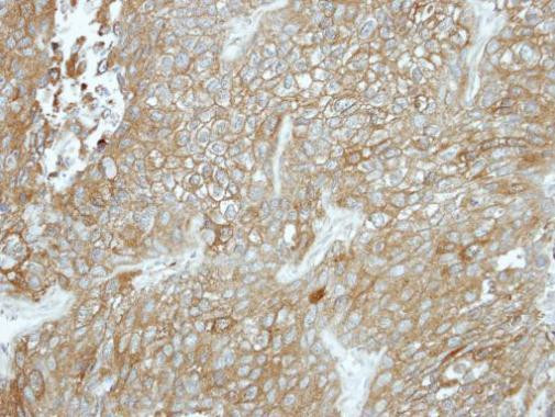 CPXM1 Antibody in Immunohistochemistry (Paraffin) (IHC (P))